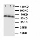 CD40 Antibody