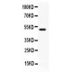 CD80 Antibody