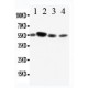 CD89 Antibody