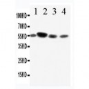 CD89 Antibody