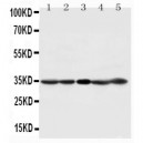 CDK1 Antibody