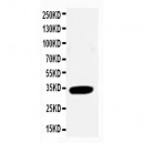 Cdk2 Antibody