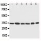 Cdk4 Antibody