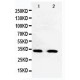 Cdk5 Antibody