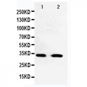 Cdk5 Antibody