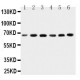 CETP Antibody