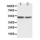 c-Fos Antibody