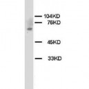 Chk2 Antibody