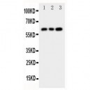 Chk2 Antibody