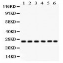 CIB1  Antibody