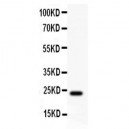 Claudin 5 Antibody