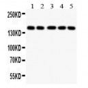 Collagen II Antibody