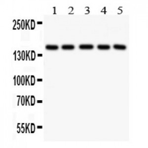 Collagen IV Antibody