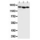 Collagen IV Antibody