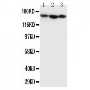 Collagen IV Antibody