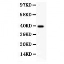 COX2/Cyclooxygenase 2  Antibody