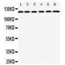 Coxsackie Adenovirus Receptor Antibody