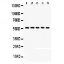 CREB3L1  Antibody