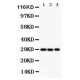 CSEN Antibody