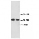 CXCR2 Antibody