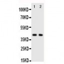 CXCR5 Antibody