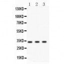 Cyclin D1  Antibody