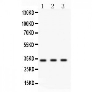 Cyclin D1  Antibody