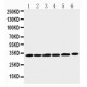 Cyclin D1 Antibody