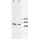 Cyclin D2 Antibody