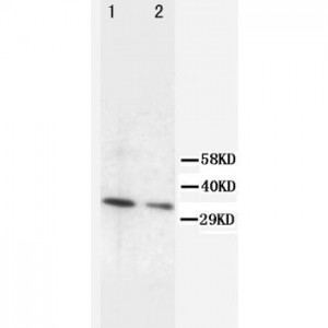 Cyclin D2 Antibody