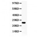 Cyclin D3  Antibody