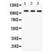 CYLD  Antibody