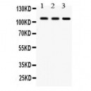 CYLD  Antibody