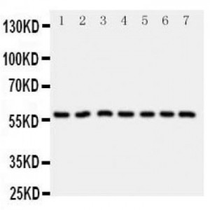 CYP11B1 Antibody