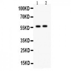 CYP7A1 Antibody