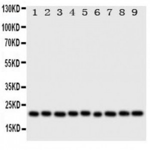 Cytoglobin Antibody