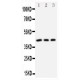 DAP Kinase 2 Antibody