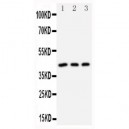 DAP Kinase 2 Antibody