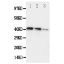 DDR2 Antibody