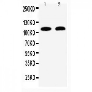 Desmoglein 3 Antibody