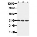 DKK1 Antibody