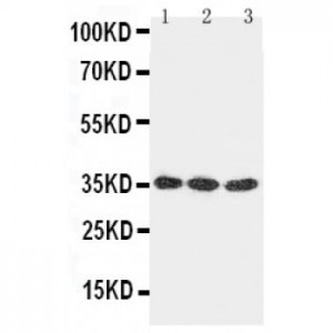 DKK1 Antibody