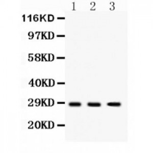 DKK2  Antibody