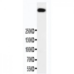 DNA PKcs Antibody