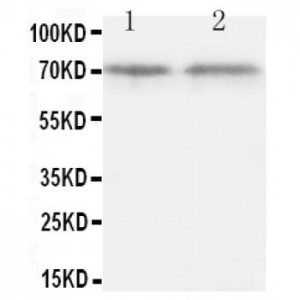 Dopamine Receptor D1 Antibody