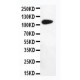 DPYD Antibody