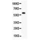 DR3 Antibody