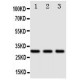 DR4 Antibody