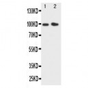 E Cadherin Antibody