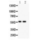 E3 SUMO-protein ligase PIAS4 Antibody